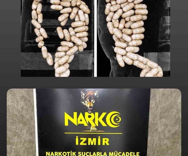 İzmir'de hava yoluyla uyuşturucu getiren 2 şüpheli, midesinden 127 kapsülle yakalandı