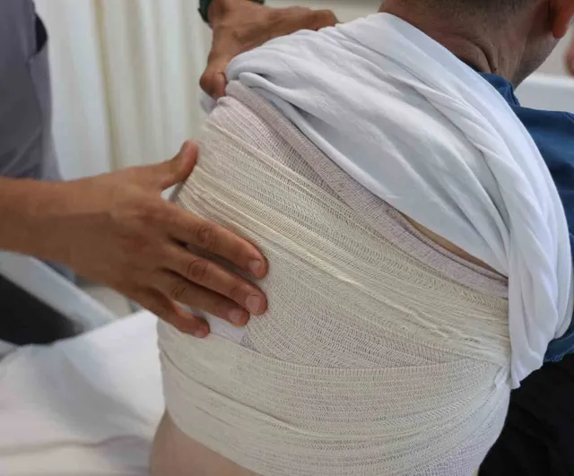 Hatay’da 10 yıldır büyüyen kitle alındı: Sırttan 1,5 kilogramlık tümör çıkarıldı