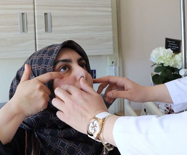Sivas'ta trigeminal nevralji tanısıyla yapılan mikrocerrahi operasyonla yüz ağrısı sonlandı