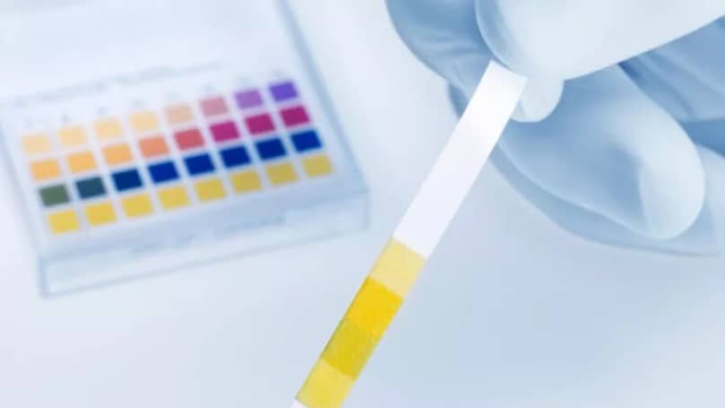 Böbreklerinizde Sorun Olduğunu Gösteren 10 Semptom