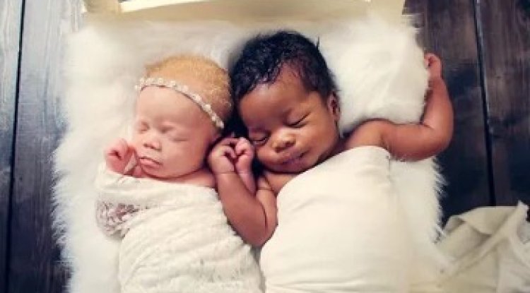 Esra Erol da skandal bir olay yaşandı. Milyonda bir ihtimal gerçek oldu. İkiz bebeklerden birisinin babası farklı!