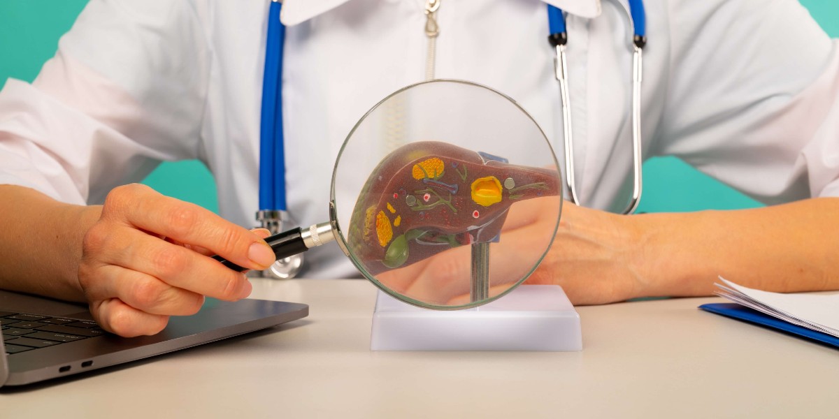 karaciger yaglanması