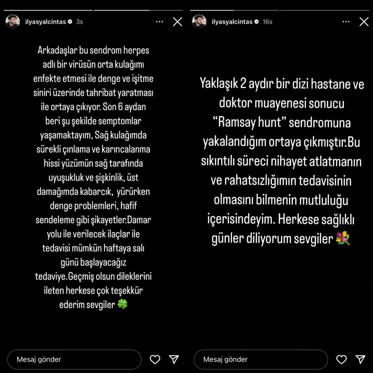 Ünlü Sanatçı İlyas Yalçıntaş’ın Hastalığı Belli Oldu: Ramsay Hunt Sendromu Nedir?