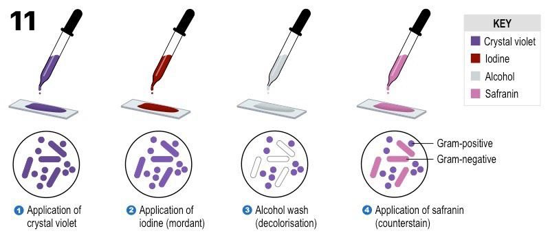 Mikroskopta Bakteri Macerası: Kendi Örneklerinizi Nasıl Hazırlar ve İncelersiniz?