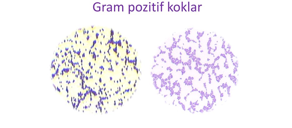 Mikroskopta Bakteri Macerası: Kendi Örneklerinizi Nasıl Hazırlar ve İncelersiniz?