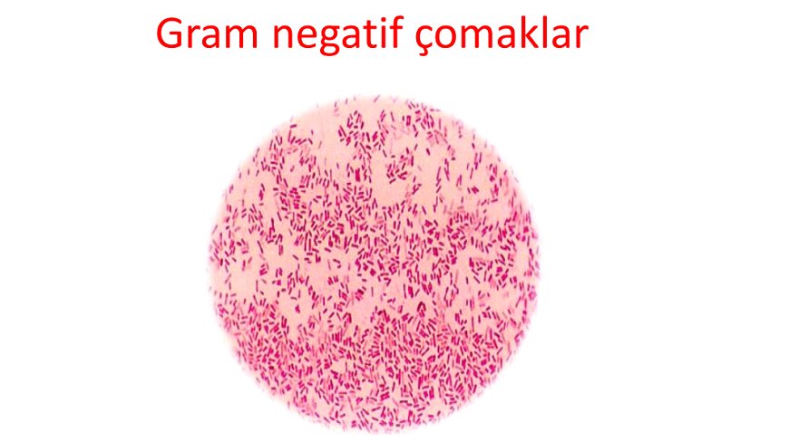 Mikroskopta Bakteri Macerası: Kendi Örneklerinizi Nasıl Hazırlar ve İncelersiniz?