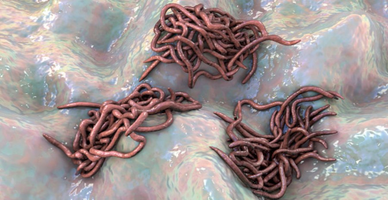 bağırsak kurtları