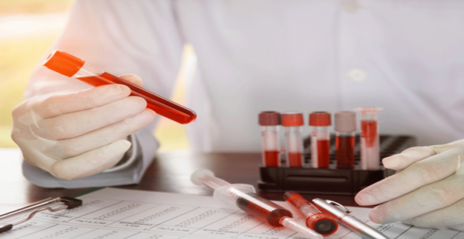 BİYOPSİ NASIL YAPILIR