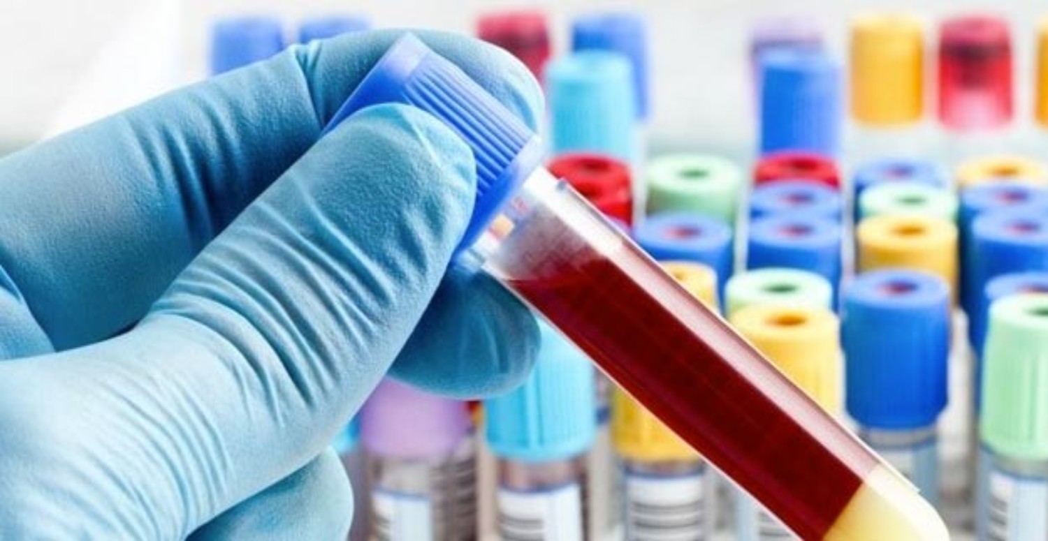 kan değeri düşmesi