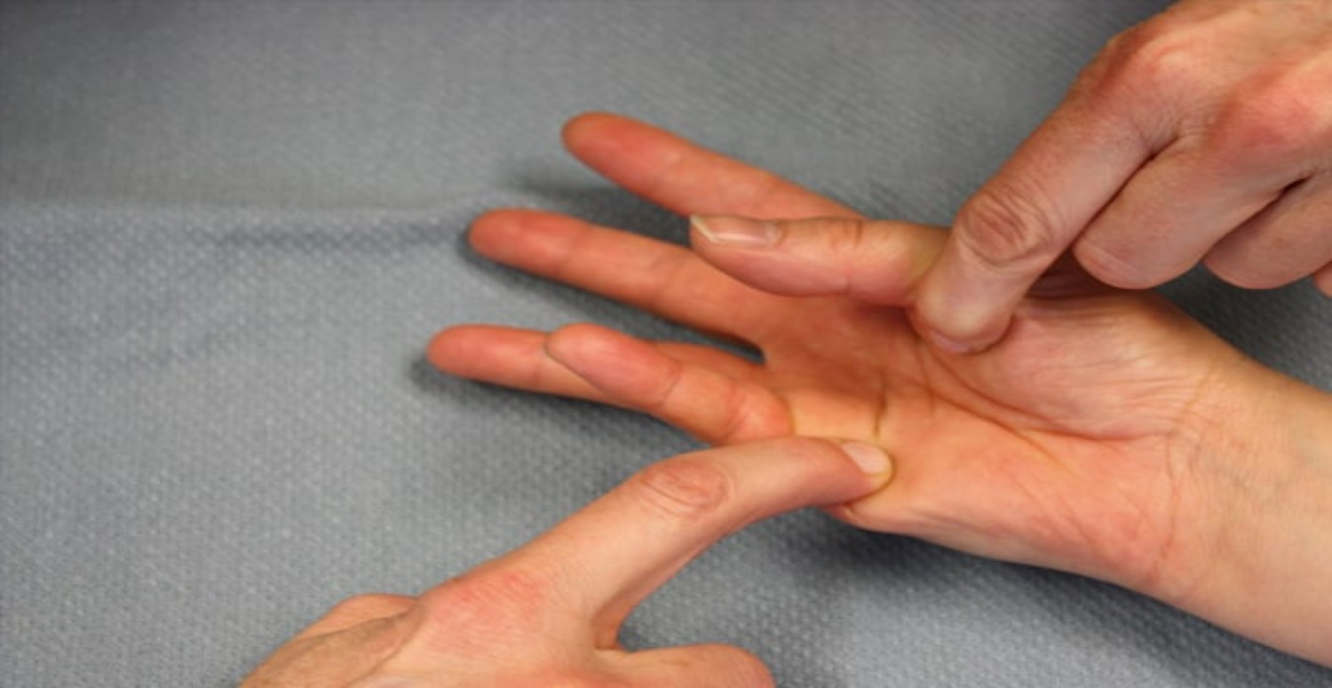 SİNİR SIKIŞMASI HAKKINDA