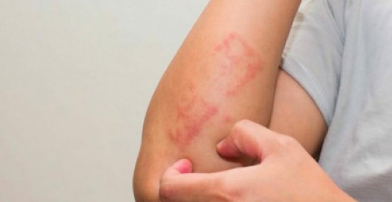 UYUZ NEREDE GÖRÜLÜR