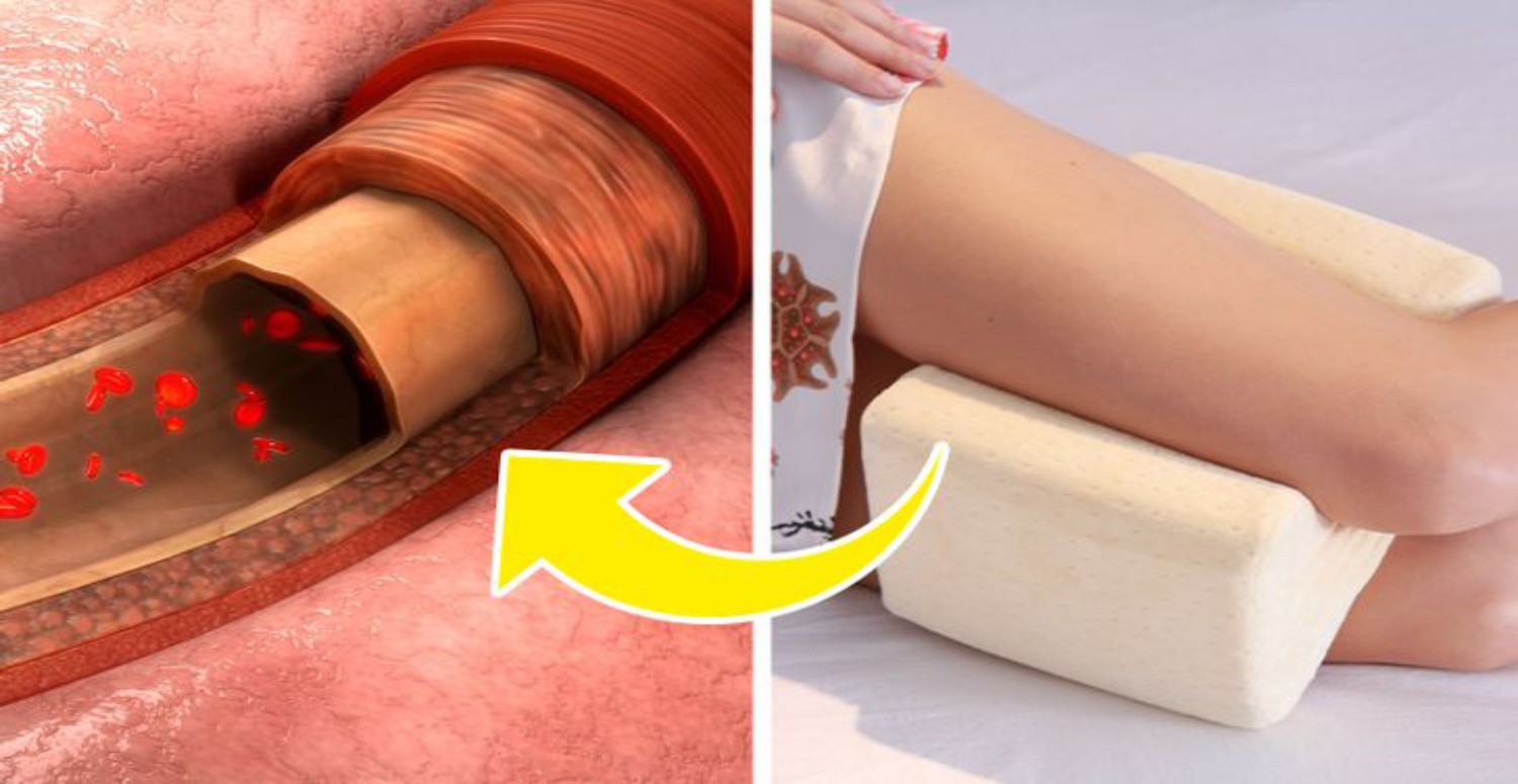 BACAK ARASINA YASTIK KOYMAK