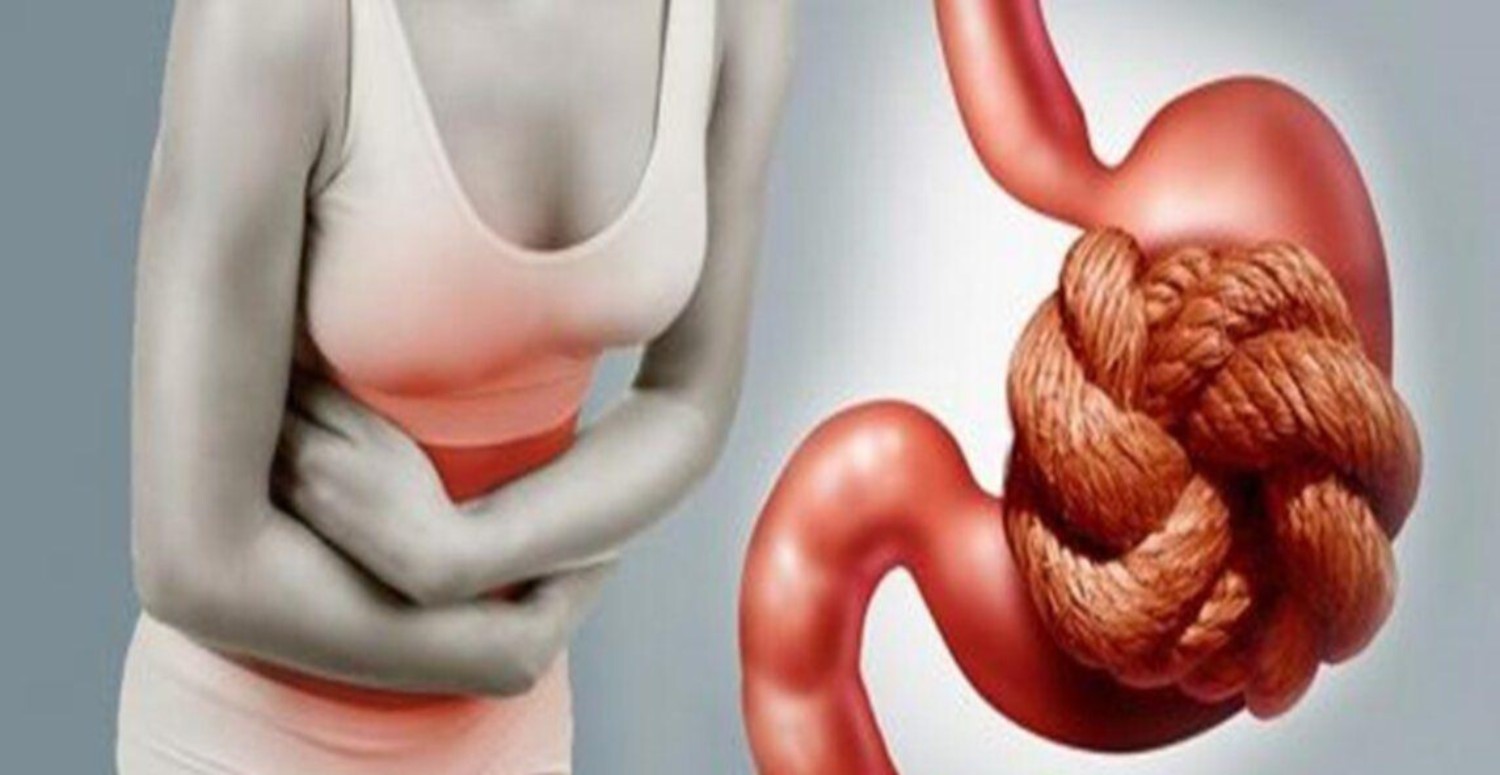 BAĞIRSAK TEMİZLİĞİ