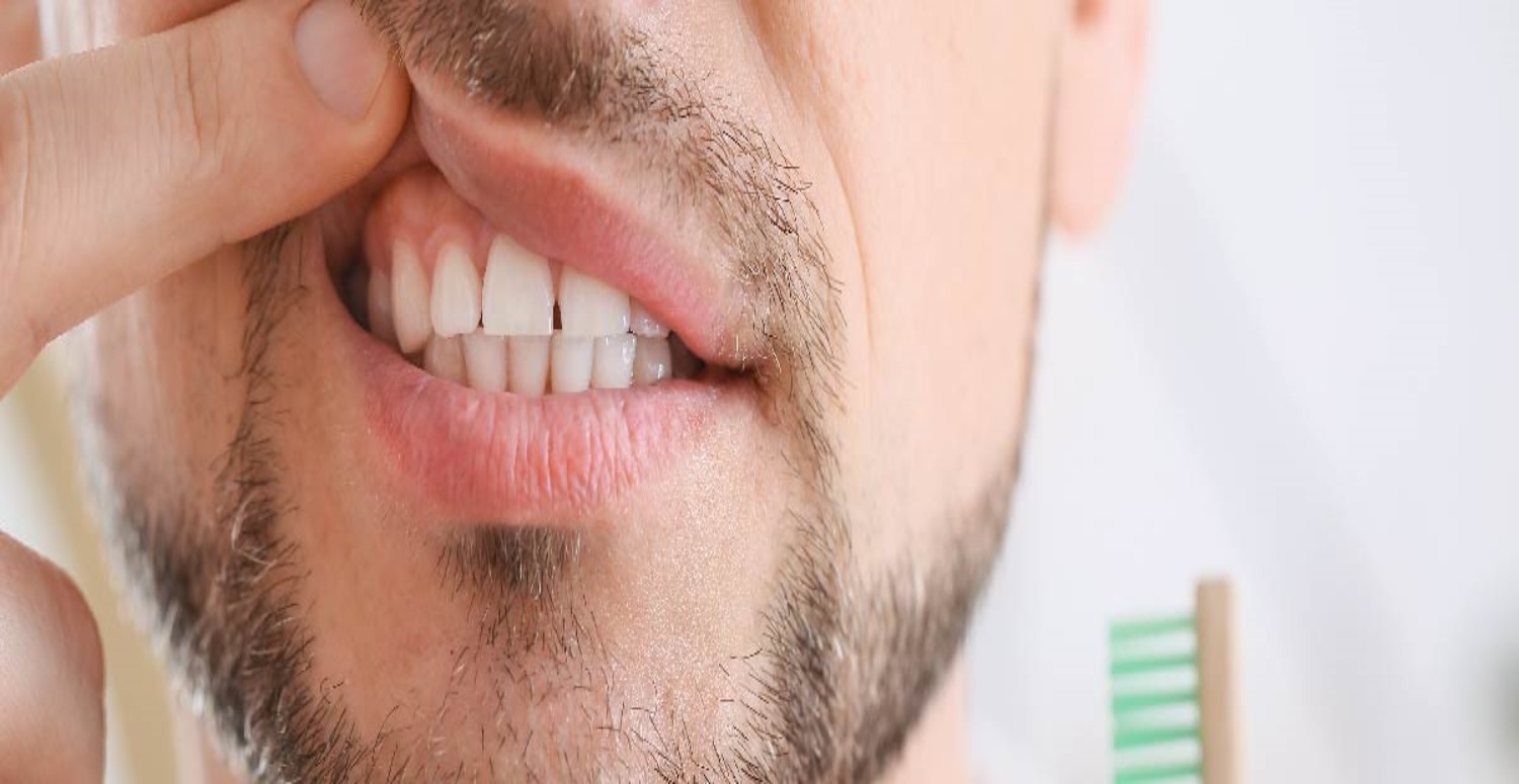 DİŞ ETİ ÇEKİLMESİ BELİRTİLERİ