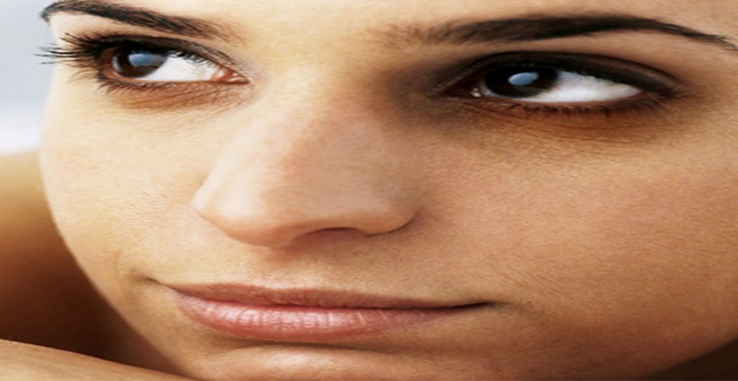 GÖZ ALTI KARARMASI SEBEPLERİ