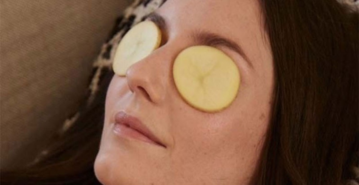 göz altı kararmasına patates
