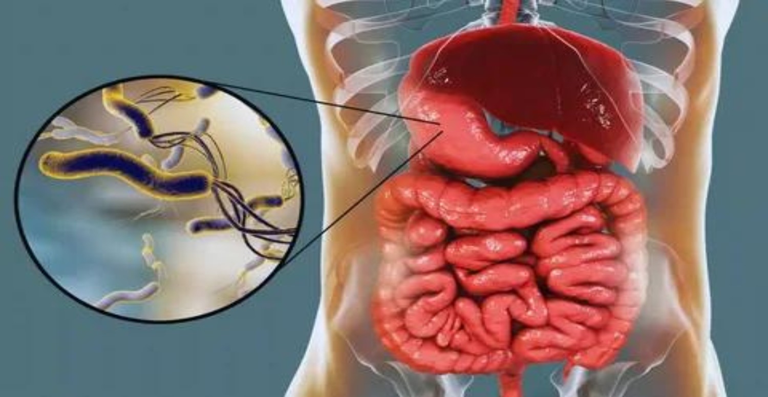 HELİCOBACTER PYLORİ