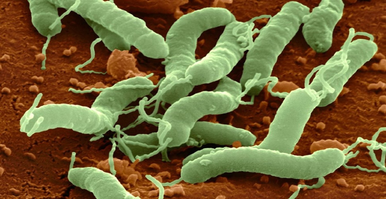 HELİCOBACTER PYLORİ TEŞHİSİ