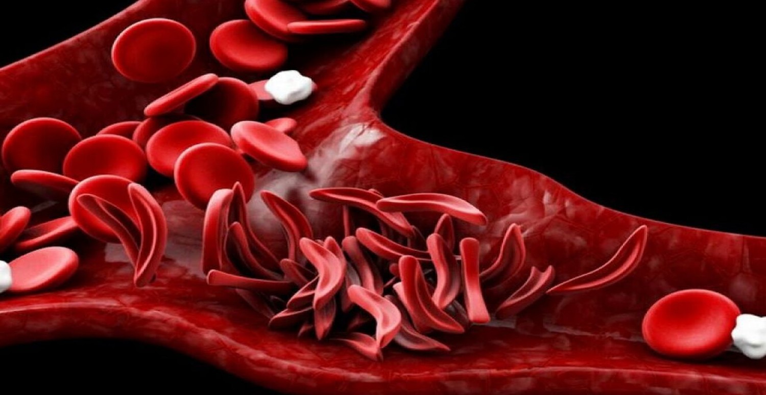 kansızlığa kapari