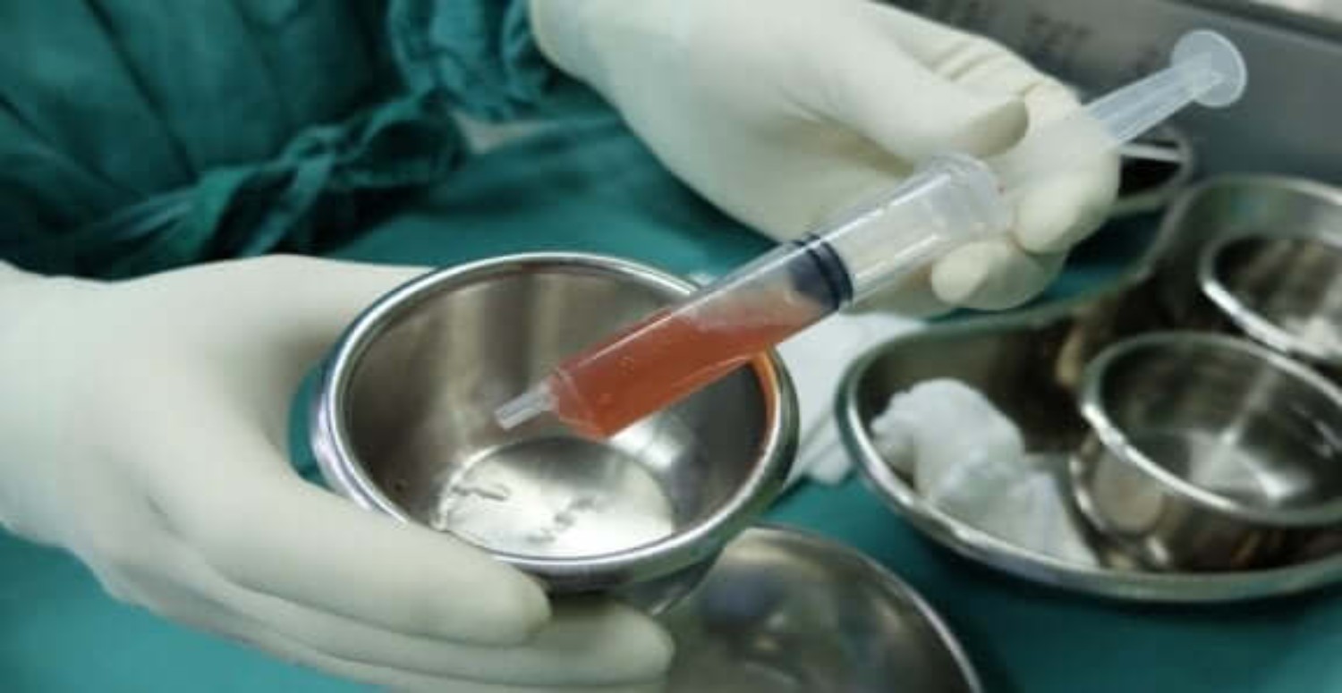 karındaki sıvı nasıl alınır