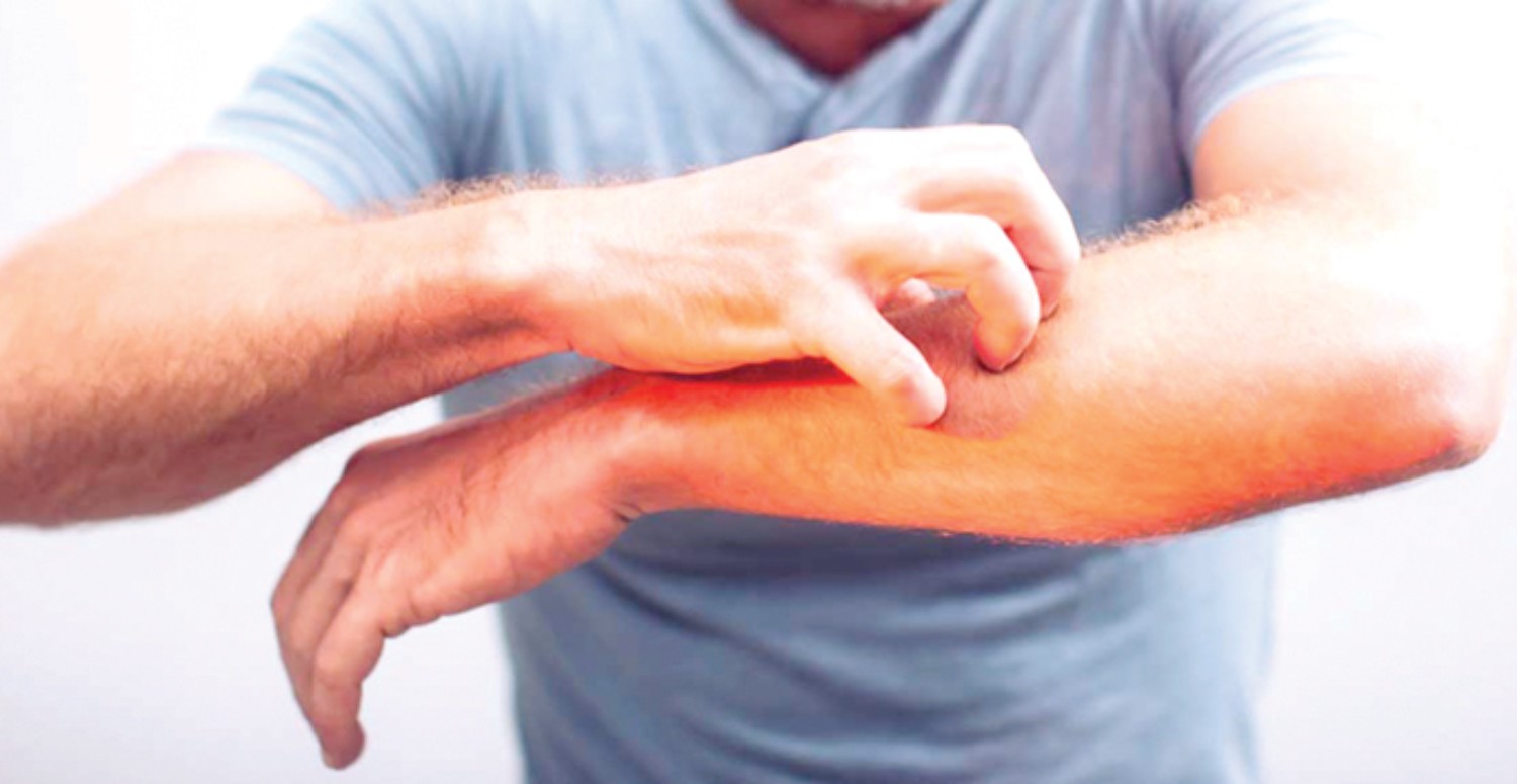 KIRMIZI ET HASSASİYETİ