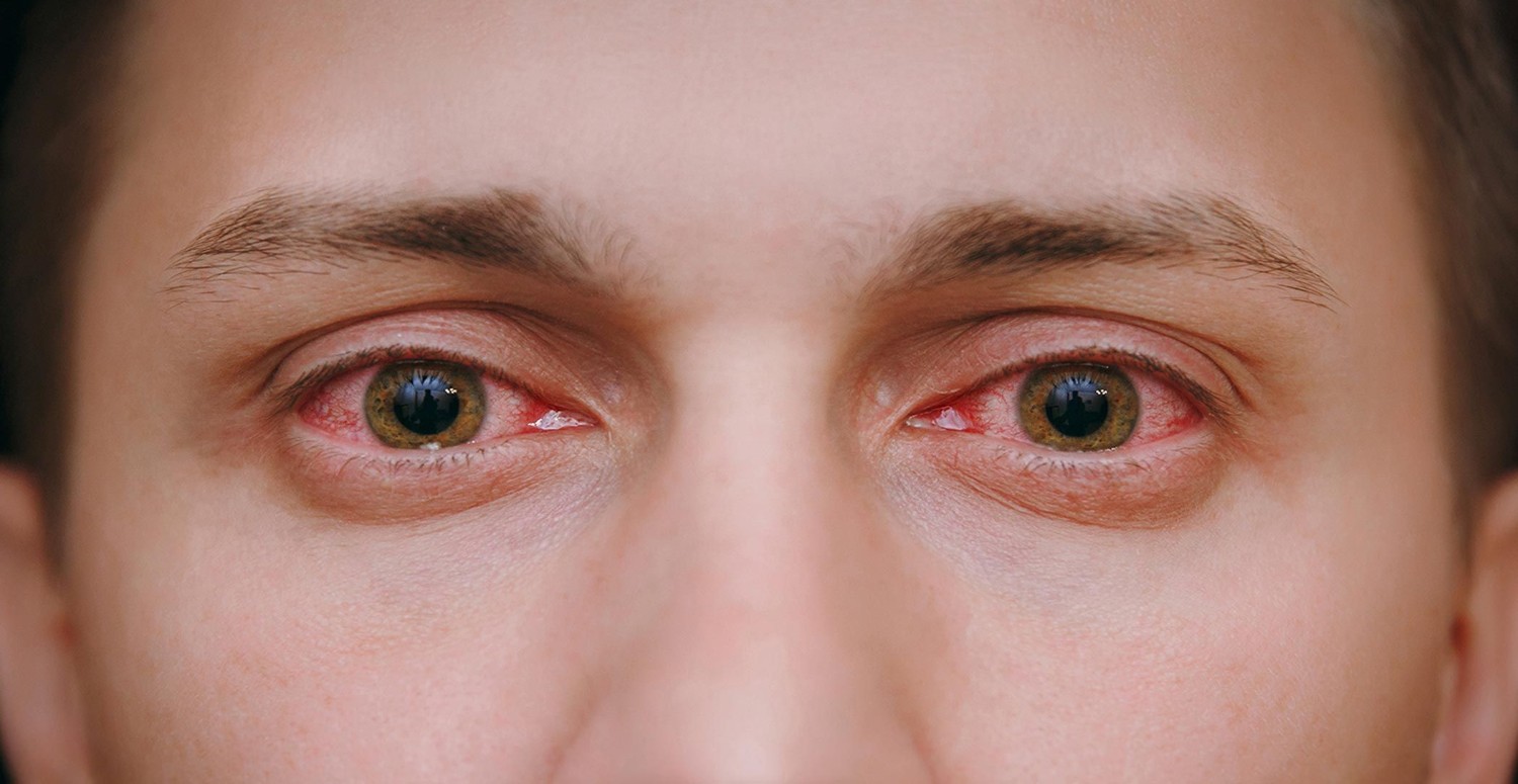 KÜF MANTARI NEYE SEBEP OLUR