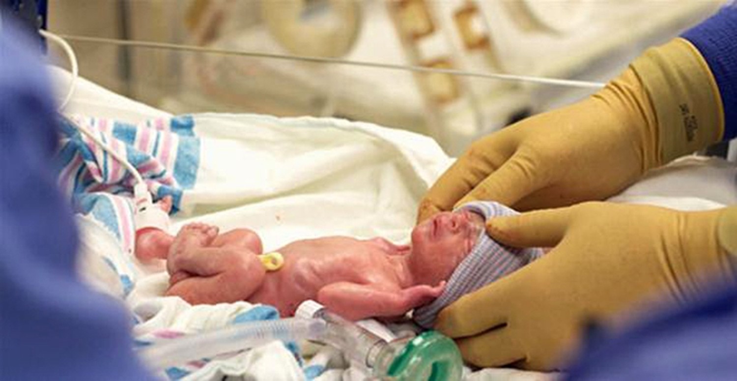 PREMATÜRE BEBEK NEDİR