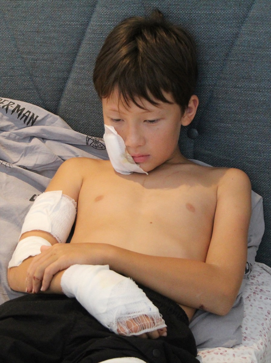 Antalya'nın Alanya ilçesinde sahipli köpeğin saldırısına uğrayan Kazakistan uyruklu 11 yaşındaki...