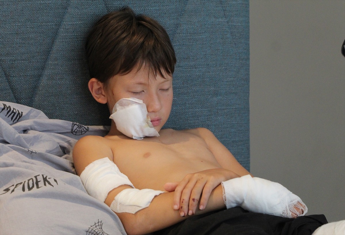 Antalya'nın Alanya ilçesinde sahipli köpeğin saldırısına uğrayan Kazakistan uyruklu 11 yaşındaki...