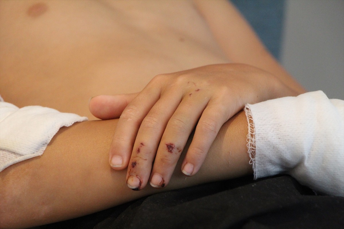 Antalya'nın Alanya ilçesinde sahipli köpeğin saldırısına uğrayan Kazakistan uyruklu 11 yaşındaki...