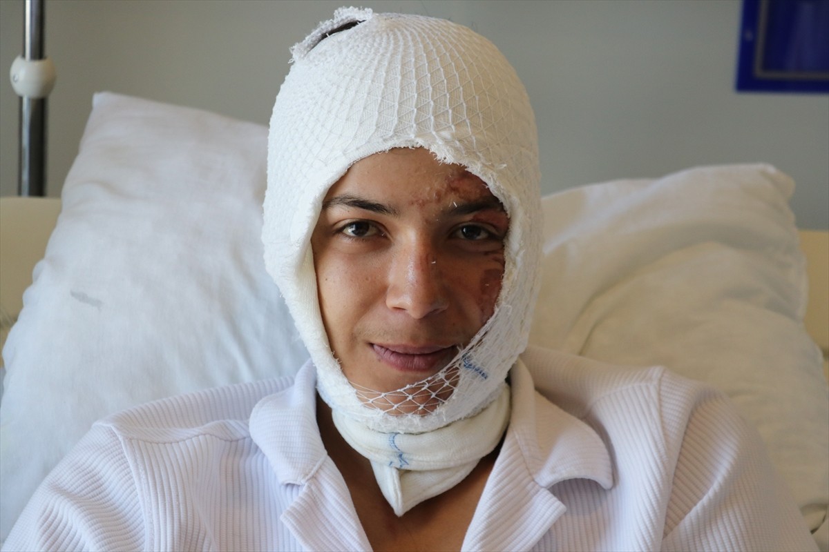 Sivas'ta otobüs durağında beklerken içmek istediği elektronik sigaranın patlaması sonucu yüzünde...