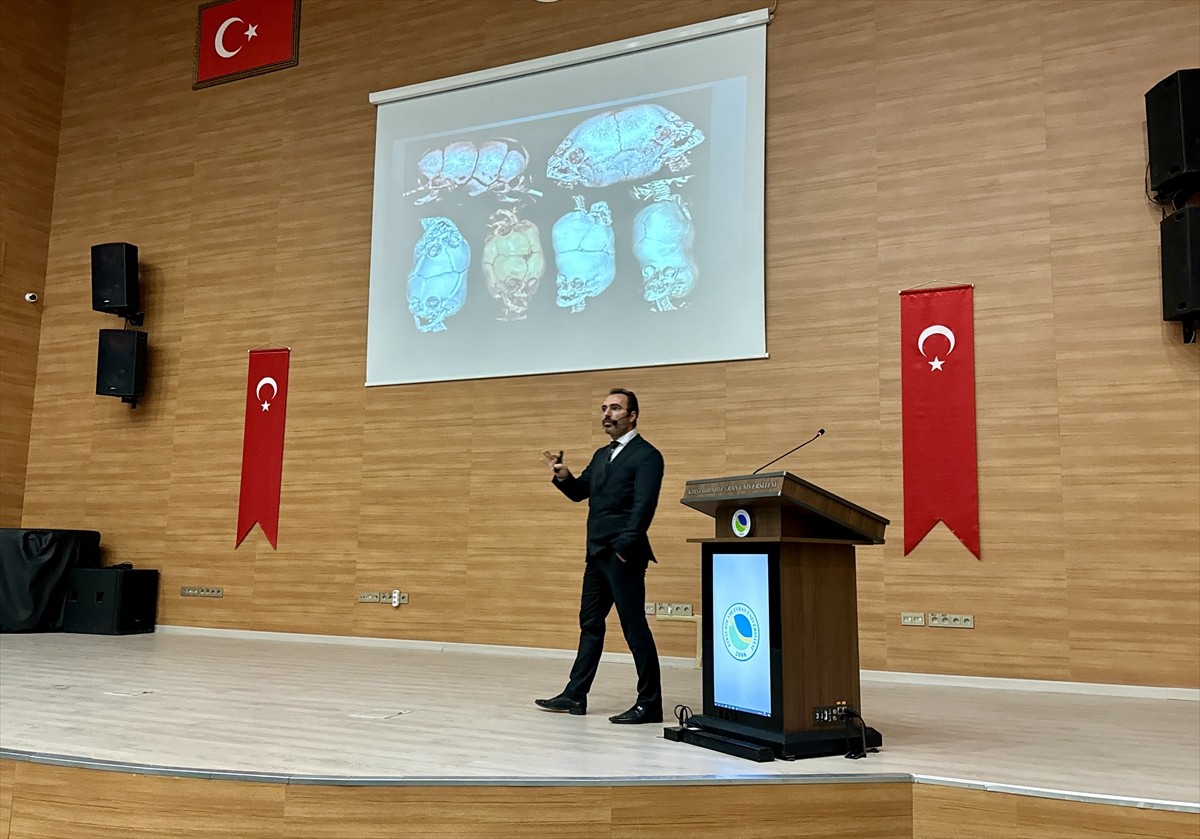 Kırşehir Ahi Evran Üniversitesi (KAEÜ) Tıp Fakültesi öğrencilerine, kafadan yapışık ikizlerin...