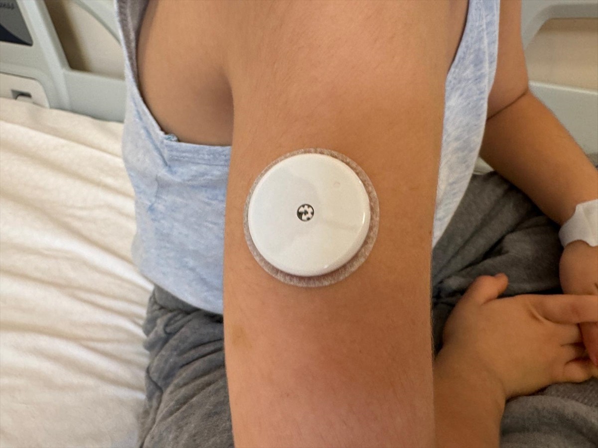 Tip 1 diyabet hastası çocuklarda parmak ucuna iğne batırılarak yapılan şeker ölçümlerini ortadan...