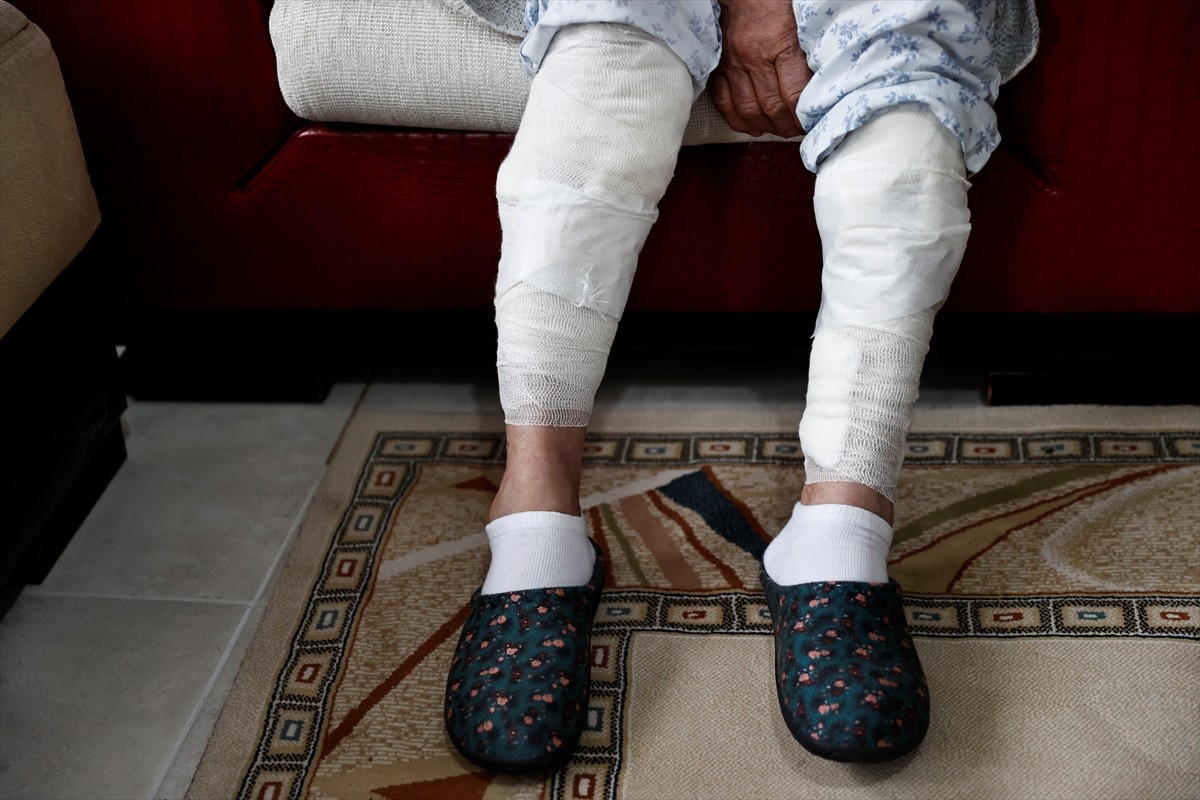 Tunceli'de bir besiciye ait köpeklerin saldırısında ağır yaralanan 65 yaşındaki Hikmet Tokmak...