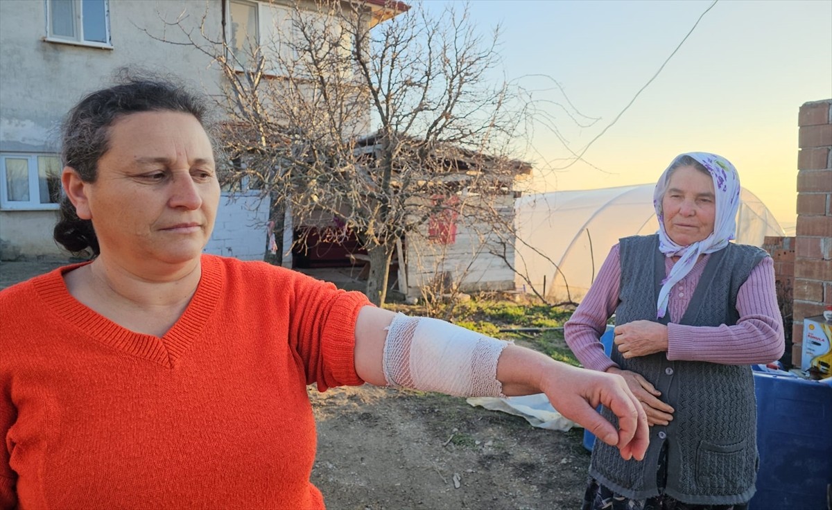 Çorum'da sahibinden kaçan rottweiler cinsi köpeğin saldırısına uğrayan 3 kişi yaralandı. Kolundan...