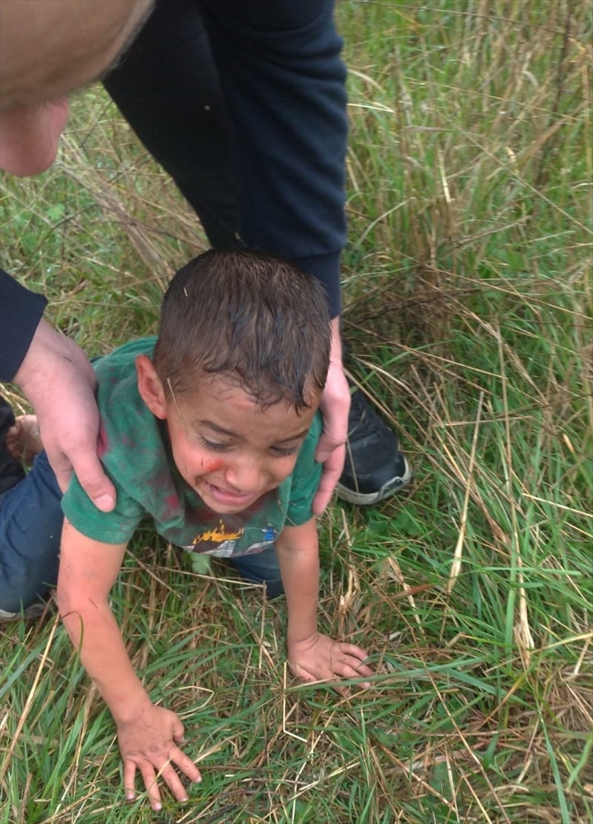 Yalova'da bakkala giderken sahipsiz köpeklerin saldırısına uğrayan 5 yaşındaki çocuk ağır...
