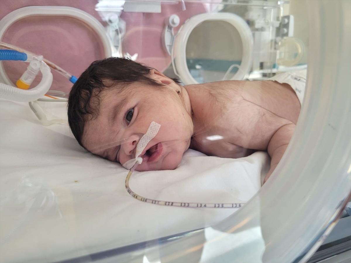 Kütahya'da 34 haftalık doğan bebeğin boynundan ameliyatla 445 gram tümör çıkarıldı.