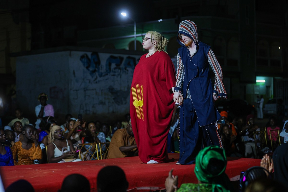 Senegal'in başkenti Dakar'da albinizmli bireylerde sık görülen cilt kanserine karşı farkındalık...