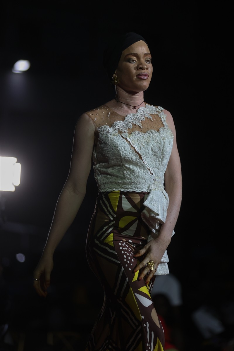 Senegal'in başkenti Dakar'da albinizmli bireylerde sık görülen cilt kanserine karşı farkındalık...