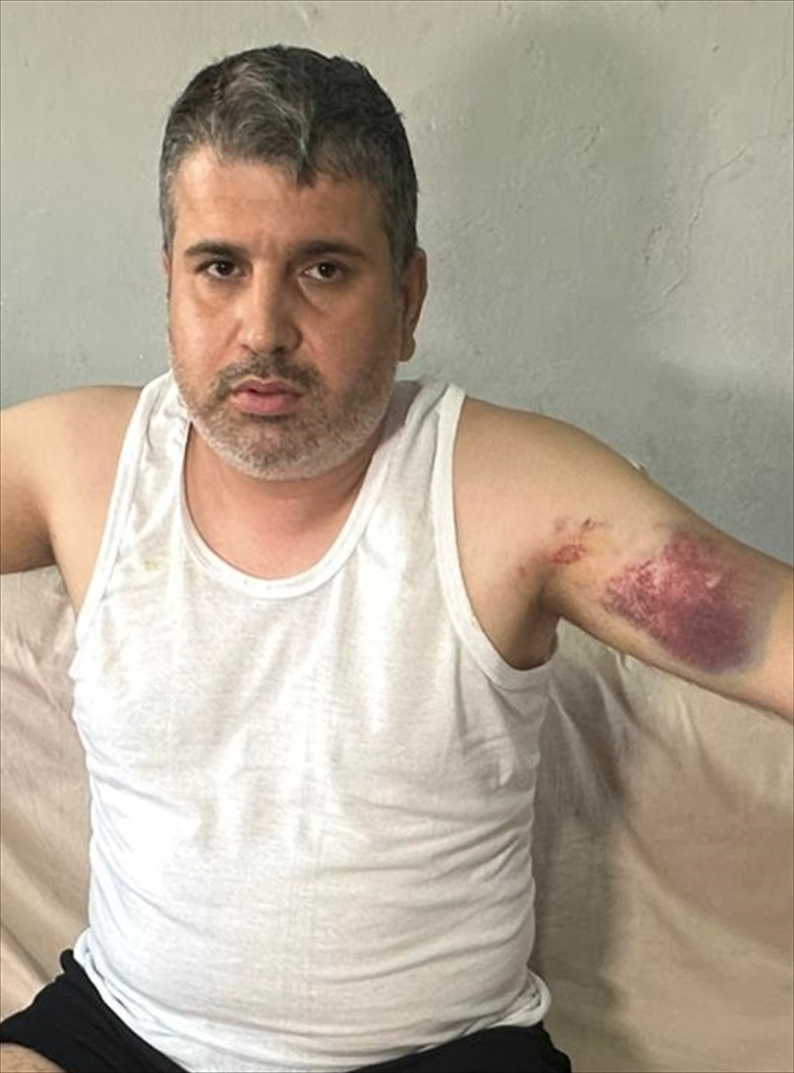 Adana'nın Seyhan ilçesinde, caddede dayısı tarafından beyzbol sopasıyla darbedilen Mehmet A, işi...