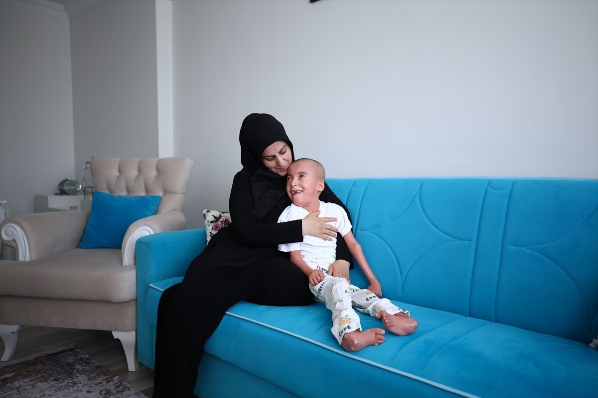 Bingöl'ün Genç ilçesinde balık pulu (iktiyozis) hastası bir oğlunu kaybeden anne Nihal Ortak...