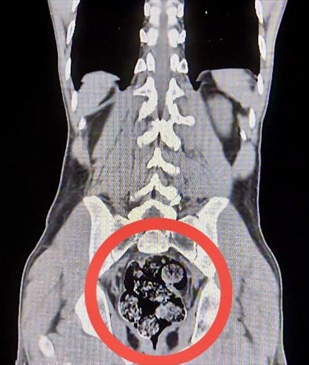 Kars'ın Susuz ilçesinde, biri mide ve bağırsaklarında sentetik uyuşturucu bulunan 2 İran uyruklu...