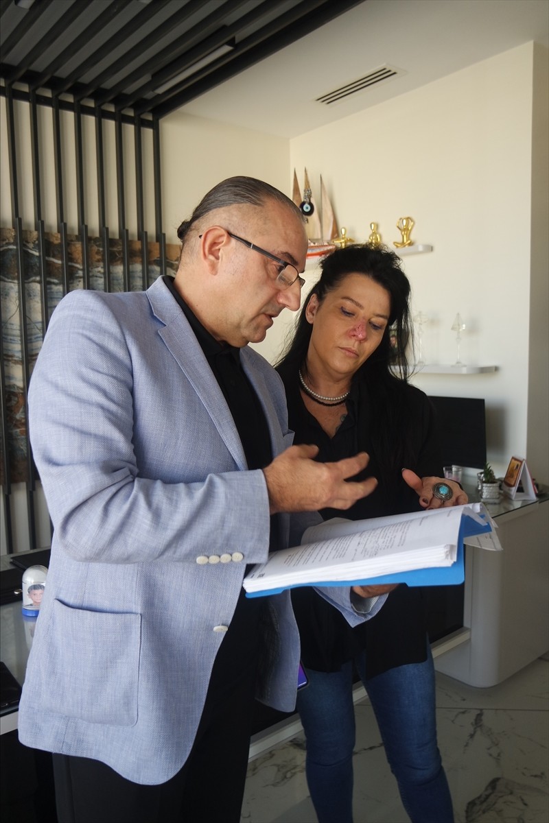 Bursa'da 2 yıl önce arkadaşının rottweiler cinsi köpeğinin saldırması sonucu yüzünde doku kaybı...