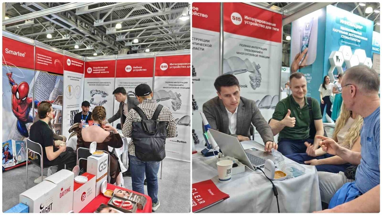 SMARTEE DENTİ-TECHNOLOGY, BU YIL YENİLİKÇİ ORTODONTİK ÇÖZÜMLERİNİ DENTAL SALON MOSKOVA, KAZDENT...