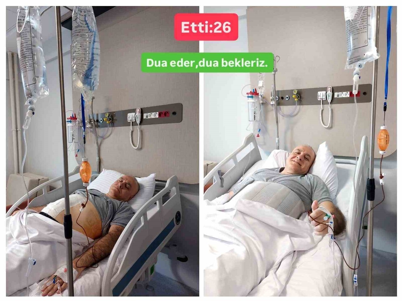 15 TEMMUZ DARBE GİRİŞİMİNDE 8 KURŞUNLA YARALANARAK GAZİ OLAN SAMSUN GARNİZON KOMUTANI TÜMGENERAL...