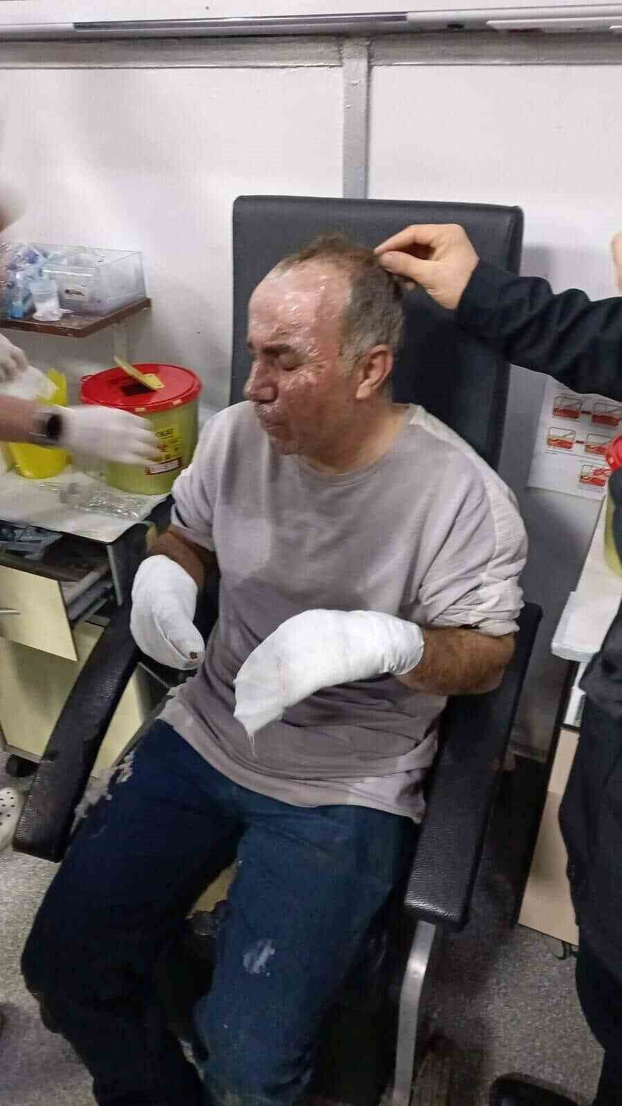 ALEV TOPUNA DÖNEN ARAÇTAN CAN HAVLİYLE AŞAĞI ATLAYIP YARALANAN ŞOFÖR EŞREF ERVA'NIN YÜZÜNDE...