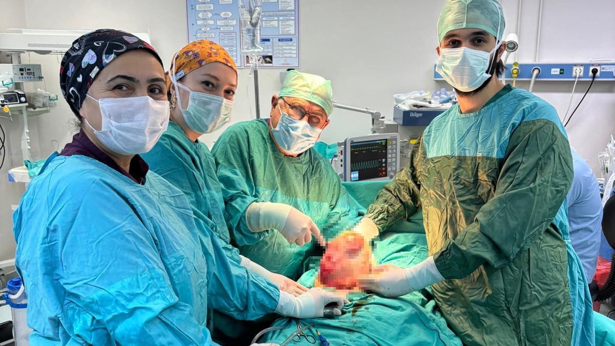 AMASYA'DA KARNININ 6 AYLIK HAMİLE GİBİ BÜYÜMESİ ÜZERİNE HASTANEYE BAŞVURAN 60 YAŞINDAKİ KADININ...