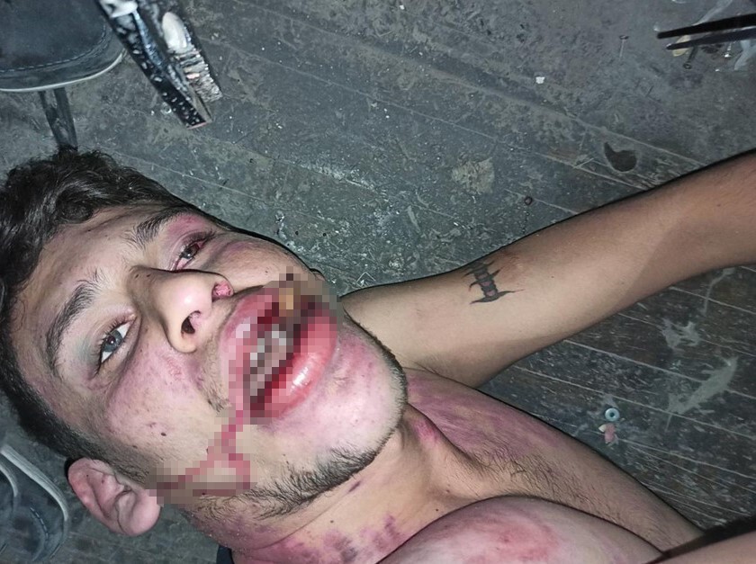 ANTALYA’DA 23 YAŞINDAKİ VEDAT KURT’A ÇALIŞTIĞI İŞ YERİNDE ÜÇ GÜN BOYUNCA İŞKENCE YAPILDIĞI...