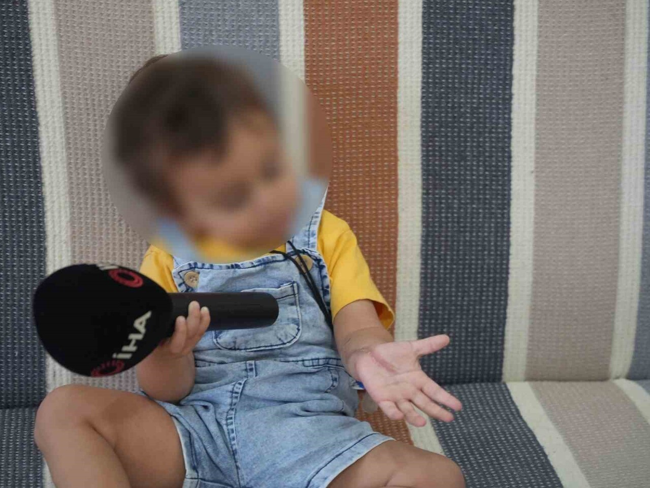 ÇOCUK İKİ AMELİYAT GEÇİRDİ VE KOLUNDA KALICI İZLER OLUŞTU