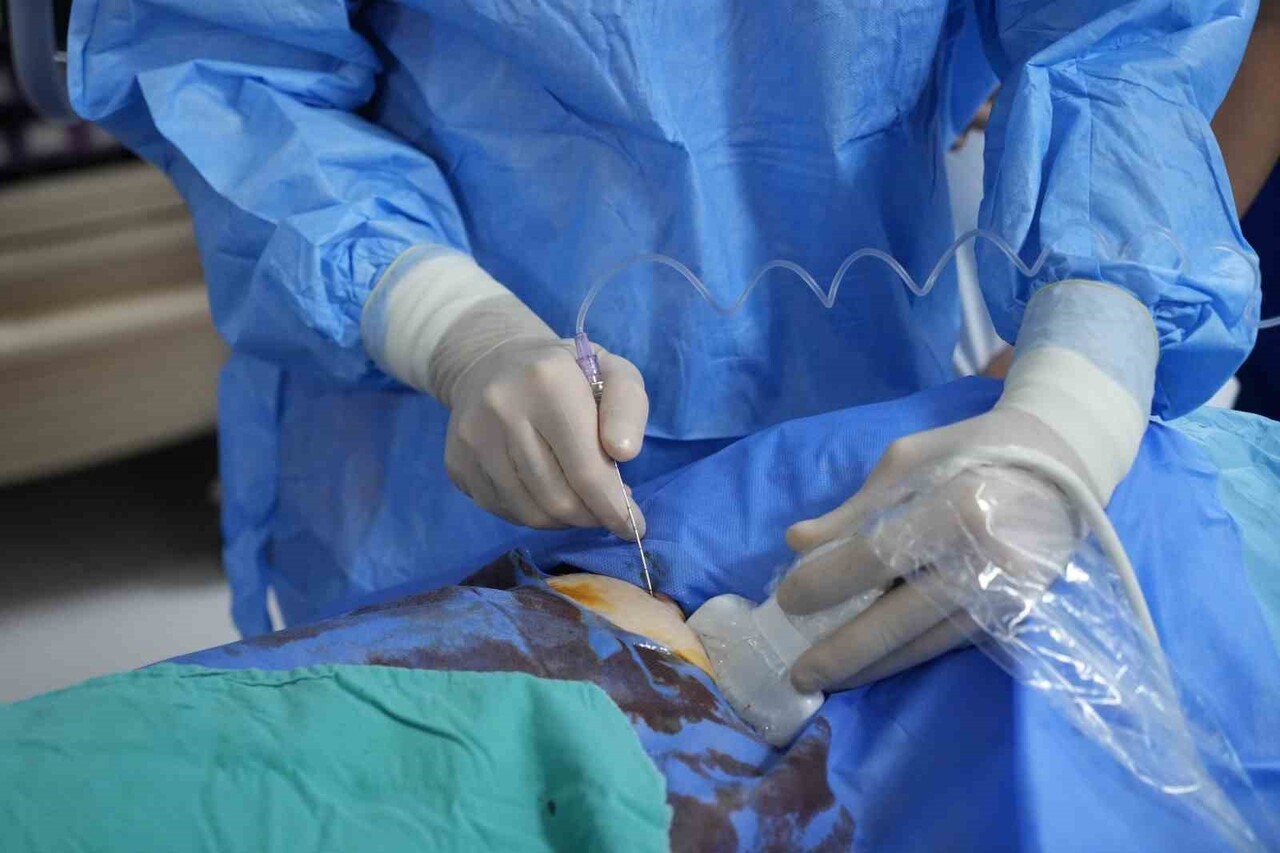 KARACİĞER, BÖBREK VE TİROİT TÜMÖRLERİNDE AMELİYATSIZ ÇÖZÜM SUNAN VE HASTALARIN AYNI GÜN TABURCU...